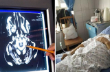 Người đàn ông 49t bị K gan: Bs nói do 1 thói quen trước khi ngủ nhiều người mắc phải, nhất là nam giới