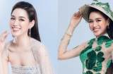 Những nàng Hậu thăng hạng nhờ chỉnh răng: Kim Duyên tỏa sáng, Đỗ Hà rạng rỡ hơn