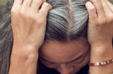 Tóc bạc nhiều bất thường đừng nghĩ mình già nhanh: Có thể bạn đang thiếu hụt 3 loại chất quan trọng này