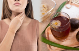 6 cách trị đau họng tại nhà, không cần uống thuốc: Đơn giản, an toàn, ai cũng dùng được