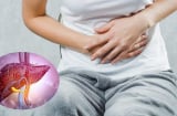 5 biểu hiện bất thường vào buổi sáng cảnh báo gan tổn thương nghiêm trọng, ai không có thì xin chúc mừng