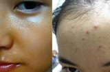 Bác sĩ da liễu chỉ mặt 7 sản phẩm càng dùng da càng xấu xí: Tránh mua kẻo phí tiền, hủy nhan