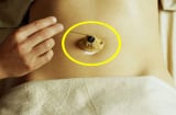 Đặt 1 miếng gừng lên rốn trước khi ngủ, sáng hôm sau tỉnh dậy sẽ thấy Sh88bet đăng ký miễn phí có 3 thay đổi kỳ diệu