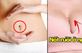 7 nốt ruồi ở 'chỗ kín' khiến phụ nữ xấu hổ nhưng chính là quý tướng, càng già càng giàu có