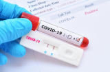 10 thao tác sai rất dễ mắc phải khi test nhanh Covid-19 tăng nguy cơ dương tính giả