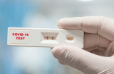 Sau khi tiếp F0, cần bao lâu thì test để có kết quả chính xác nhất?