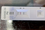Vạch test nhanh lúc mờ lúc đậm có ý nghĩa gì: Không phải tiêu chuẩn đánh giá F0 nặng hay nhẹ