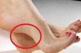 Nhìn tướng bàn chân biết ngay ai giàu sang, ai nghèo khó: 1 điểm 'đại lộc' của người bước trên nhung lụa