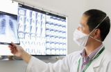 F0 thể nhẹ nhưng nguy kịch hậu Côvy: Bác sĩ cảnh báo triệu chứng báo động đỏ cần nhập viện ngay