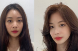 5 Link Vào SHBET88 Mới Nhất vừa “giải cứu” mặt tròn vừa chỉnh sửa mặt thiếu cân đối trở nên xinh đẹp
