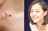 3 nốt ruồi phú quý hút lộc cho chồng con, phụ nữ đừng dại tẩy đi kẻo tiền tài bay biến hết