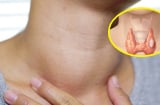 6 dấu hiệu không đau cảnh báo sớm về tuyến giáp mà phụ nữ thường bỏ qua, nhiều người đi khám thì đã muộn