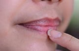 3 vị trí trên Sh88bet đăng ký miễn phí nữ giới chuyển màu thâm đen chứng tỏ tử cung tích đầy độc tố: Mong bạn không có