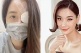 Showbiz 25/4: Mai Phương Thúy gây lo lắng khi đăng ảnh băng bó mắt, Lê Thúy nhập viện vì ngộ độc thực phẩm