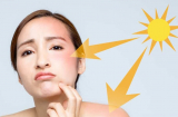 3 mẹo đơn giản giúp 'cấp cứu' Mừng SHBET phiên bản mới 2025 bị cháy nắng, làm dịu cơn bỏng rát