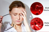 10 dấu hiệu cho thấy Sh88bet đăng ký miễn phí đang thiếu sắt nghiêm trọng, nhiều người chủ quan không đi khám
