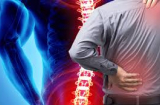 5 sai lầm gây thoái hóa cột sống cổ trước tuổi 30, điều đầu tiên dân văn phòng mắc nhiều nhất