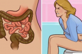 5 dấu hiệu cảnh báo căn bệnh trực tràng, phát hiện thấy 1 nên đi kiểm tra sớm