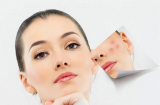 Nằm lòng 4 nguyên tắc 'vàng' để trị thâm mụn hiệu quả tại nhà nàng có thể học hỏi