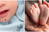 Trẻ có 4 nốt ruồi là phước báu, lớn lên làm quan to, cuộc đời hưởng vinh hoa phú quý 'cả họ được nhờ'