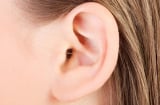 Người có 1 trong 3 vị trí này rậm lông may mắn hết phần thiên hạ, Thần Tài che chở giàu có viên mãn