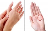 4 nốt ruồi ở lòng bàn tay tượng trưng cho Tài - Lộc - Phát - Thọ chỉ 1/4 cũng sung túc viên mãn