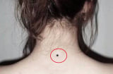 Cổ nhân dạy: Người có 4 nốt ruồi hồng phúc, cuộc đời may mắn, tiền của dư dả