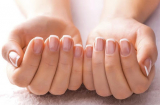 Mẹo nhỏ giúp cải thiện móng tay vàng xỉn màu trở nên trắng hồng, khỏe mạnh