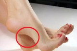 Bàn chân có một trong 7 đặc điểm này là người giỏi kiếm tiền, về già an nhàn đủ đầy