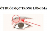4 nốt ruồi quý hơn vàng, người có 1/4 cũng đủ may mắn, cuối 2022 tiền bạc đồi dào