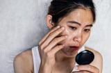 3 thói quen khiến Mừng SHBET phiên bản mới 2025 sạm đen, thậm chí gây lão hóa cực nhanh nhưng các chị em vẫn luôn chủ quan
