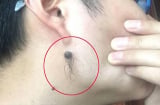 Các cụ nói: 'Lông mọc nhiều thì phát tài phát lộc, chính là ở 3 chỗ này', chớ dại mà tẩy đi