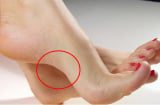 Bàn chân có 5 nét tướng này tượng trưng cho Tài - Lộc - Phúc, cả đời phú quý