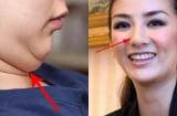 Phụ nữ có 4 chỗ to tròn tượng trưng cho Tài - Lộc - Phúc, cả đời sung túc, không lo thiếu tiền