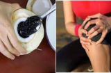 Đậu đen hầm với thứ này chữa đau nhức xương khớp, mất ngủ rất tốt: Ăn 1 lần/tuần sẽ thấy tác dụng kì diệu