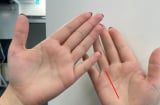 Lòng bàn tay có dấu hiệu này, công danh vượng phát, không lo thiếu tiền