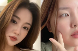 6 cách ngăn ngừa mụn để duy trì Mừng SHBET phiên bản mới 2025 mịn màng, nhan sắc tươi xinh ngày Tết