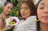 Dàn mỹ nhân Việt từng 'chật vật' vì mụn giờ đã lấy lại phong độ nhan sắc đỉnh cao