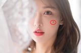 5 nốt ruồi quý hơn vàng, phụ nữ có 1/5 cũng đủ may mắn, cả đời giàu sang