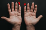 Nhìn ngón tay út 3 giây: Ai có điểm này là Thần Tài 'đánh dấu', vận đỏ hơn người
