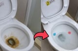 Bồn cầu dùng lâu đóng cặn vàng khè, dội thứ nước này sau 15 phút là sạch bong kin kít