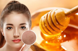 4 cách đánh bay mụn, giúp da trắng sáng mịn màng từ Link Vào SHBET88 Mới Nhất