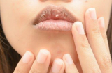 7 cách trị môi khô, nứt nẻ nhanh - gọn - lẹ có thể áp dụng quanh năm
