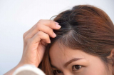 Mẹo ngăn ngừa tóc bạc sớm giúp chị em tự tin hơn với ngoại hình tươi trẻ