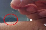 Tổ Tiên chỉ dạy: 3 vị trí lông mọc nhiều thì phát tài phát lộc, đừng dại mà tẩy đi
