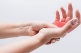 Hay bị tê tay chân, bổ sung 4 thứ này để giảm tê hiệu quả