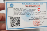 Nhìn ký hiệu này trên thẻ BHYT biết ngay mức hưởng BHYT cao nhất là bao nhiêu phần trăm