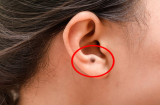 5 nốt ruồi là 'hố tiền chôn', ai có 1 thôi tiền tiên thoải mái, cả đời không lo cơm ăn áo mặc