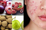 Thỏa thích ăn hoa quả nóng như mận, nhãn vải mà không lo xấu xí nổi mụn khi biết các cách dưới đây
