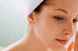6 nguyên nhân khiến da bị nám, tàn nhang và loạt bí kíp giải quyết tình trạng này